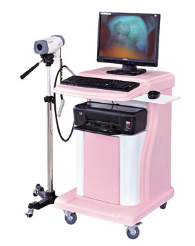 电子阴道镜诊断系统(增强型)