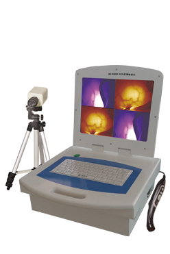 电脑彩色乳腺诊断仪(多媒体)